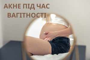 Акне під час вагітності