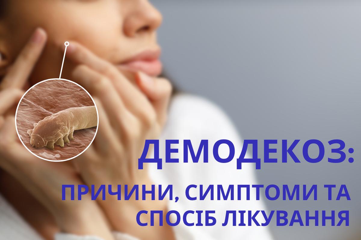 Демодекоз: причини, симптоми та спосіб лікування