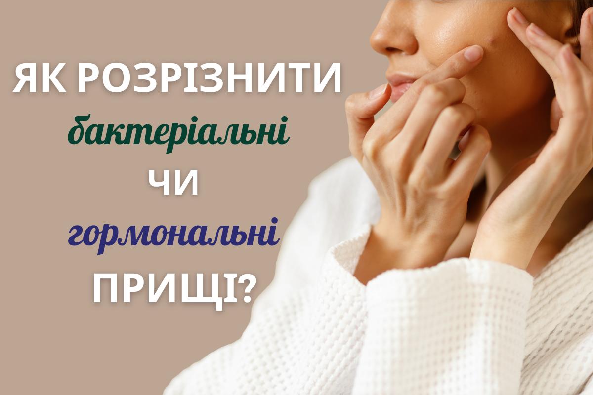 Як розрізнити бактеріальні чи гормональні прищі?