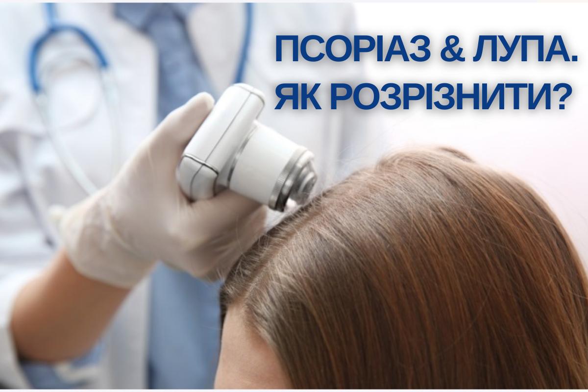 Псоріаз & Лупа. Як розрізнити?