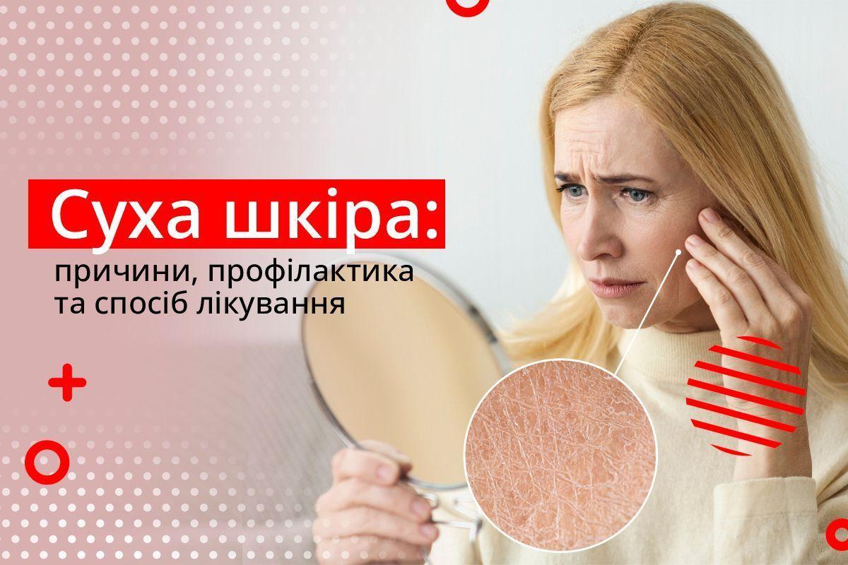 Суха шкіра: причини, профілактика та спосіб лікування