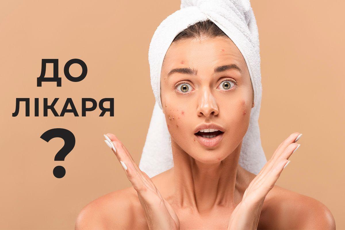 Акне. Коли поодинокі висипи сигналізують про похід до лікаря