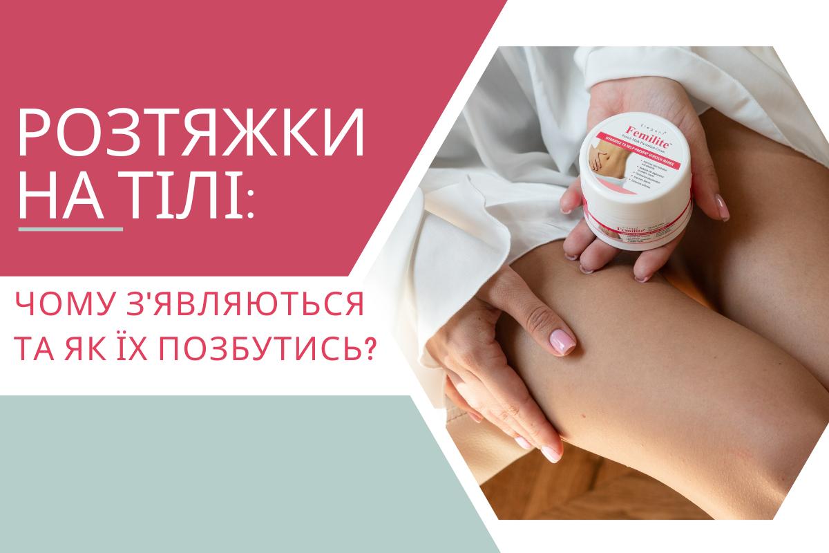 Розтяжки на тілі: чому з'являються та як їх позбутись?