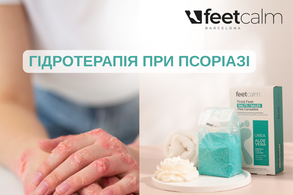 ГІДРОТЕРАПІЯ ПРИ ПСОРІАЗІ