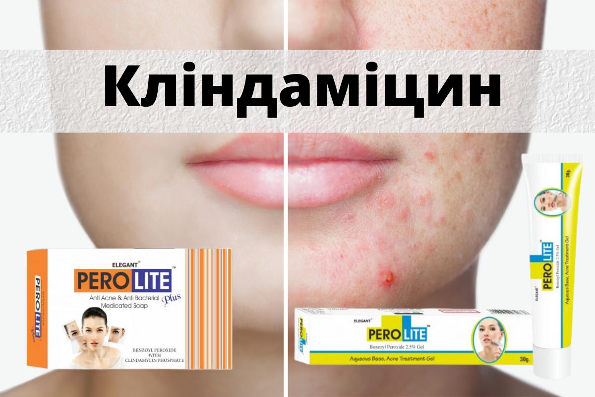 Кліндаміцин