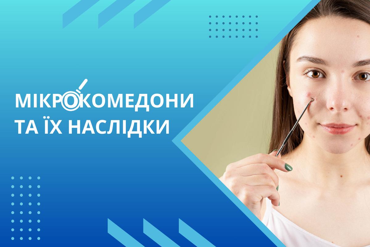 Мікрокомедони та їх наслідки