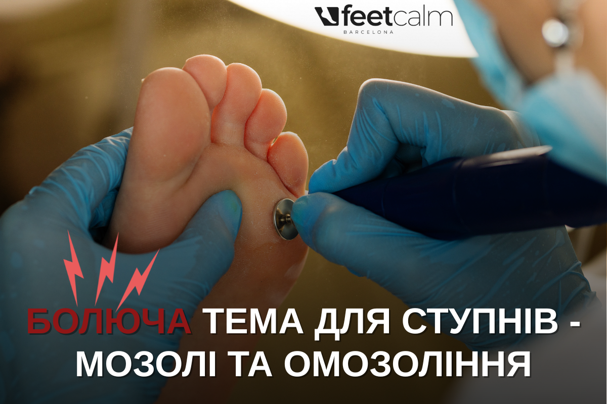 Болюча тема для ступнів -  мозолі та омозоління