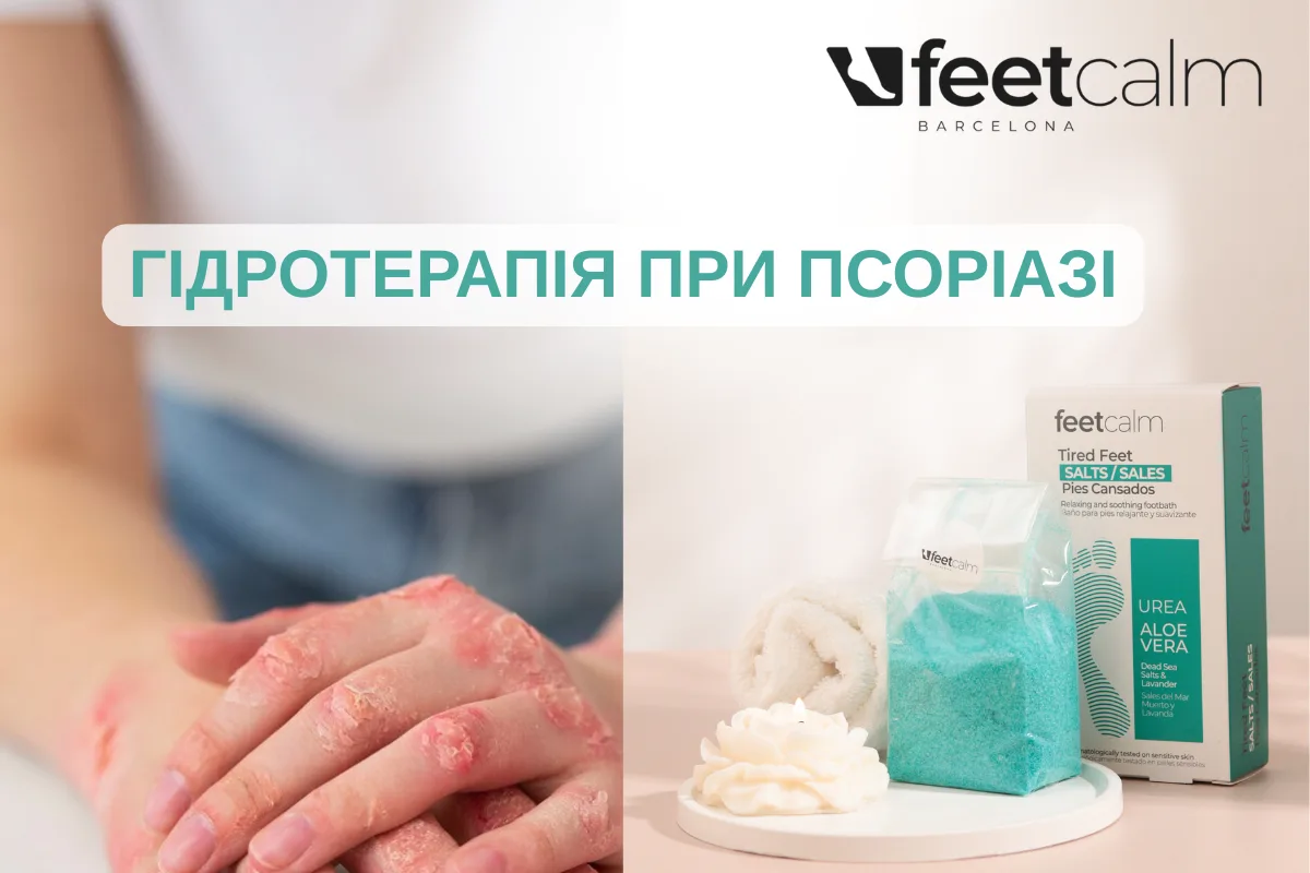 Гидротерапия при псориазе